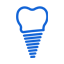implant-dentistry